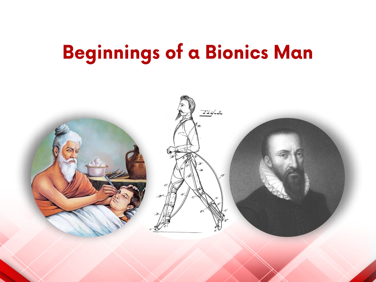 Beginnings of a Bionics Man