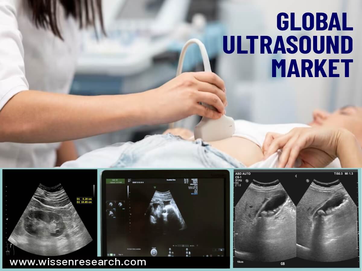 Global Ultrasound Market