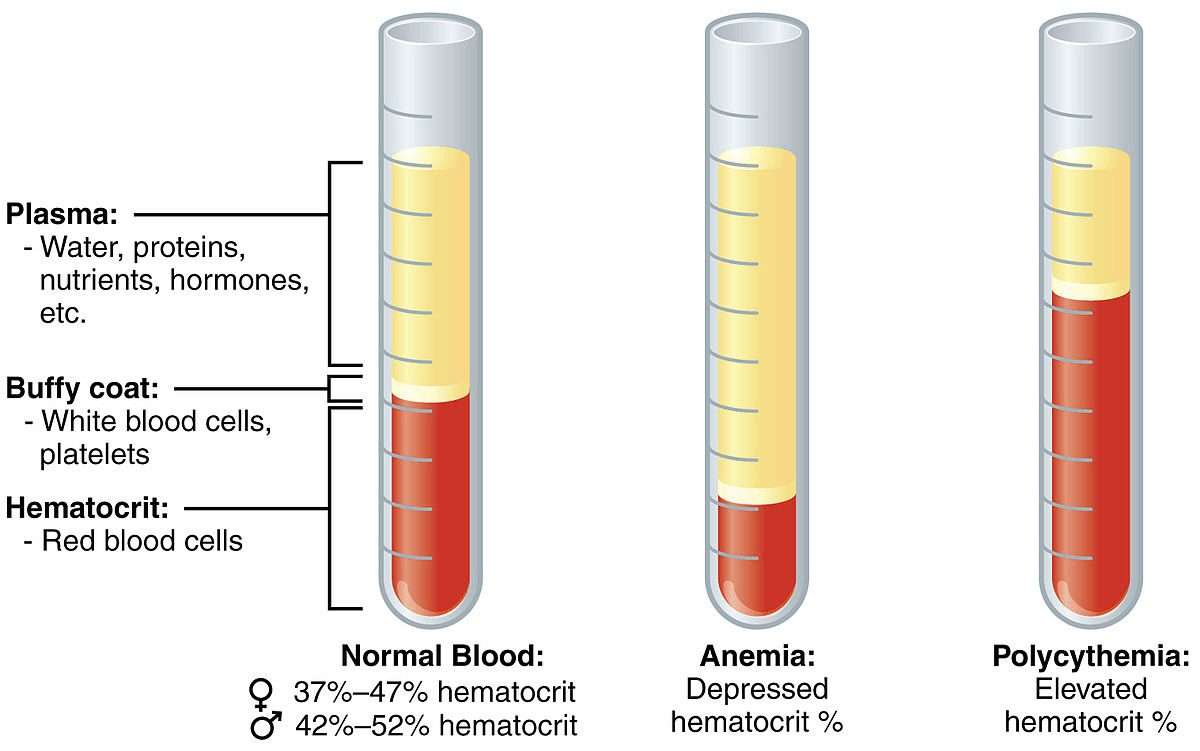 Blood composition in Polycythemia