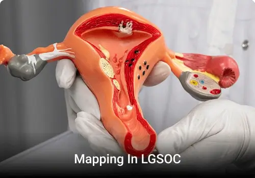 Unmet Needs and Innovation Mapping in LGSOC