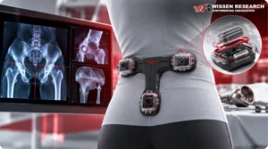 hip replacement image