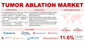Tumor Ablation Market